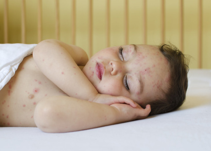 Early Life Conditions Can Make You Sick Later